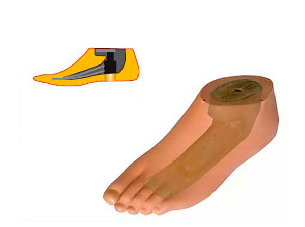 Модель 543 - протез мужской стопы тип SACH